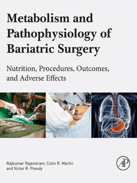 Book Metabolism and Pathophysiology of Bariatric Surgery: Nutrition, Procedures, Outcomes and Adverse Effects free