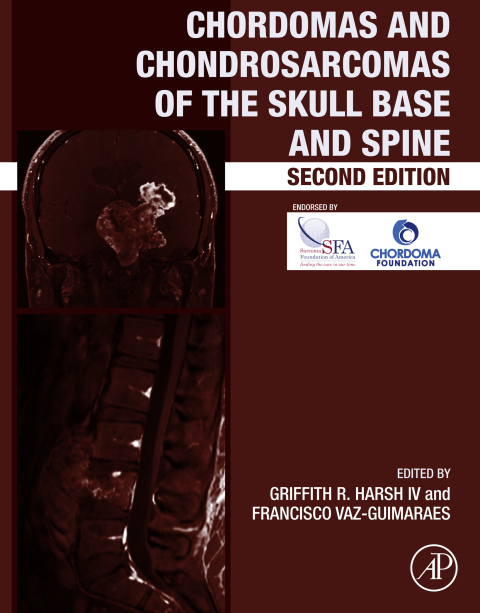 Book Chordomas and Chondrosarcomas of the Skull Base and Spine free