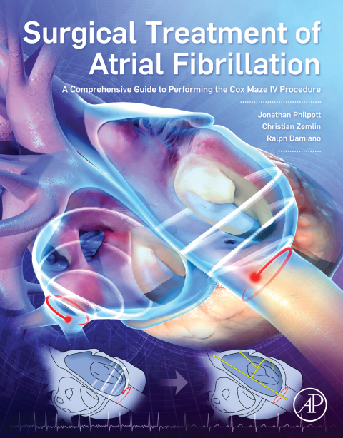 Book Surgical Treatment of Atrial Fibrillation free