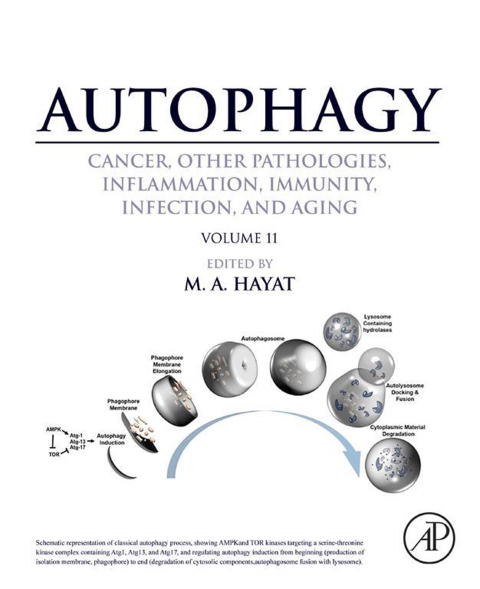 Book Autophagy: Cancer, Other Pathologies, Inflammation, Immunity, Infection, and Aging free