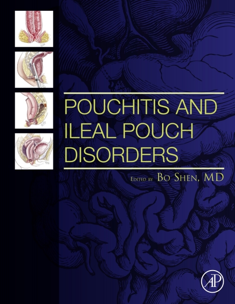 Book Pouchitis and Ileal Pouch Disorders free