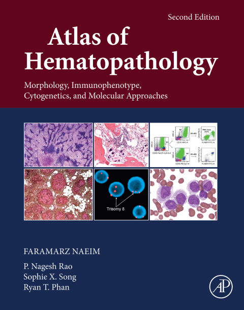 Book Atlas of Hematopathology: Morphology, Immunophenotype, Cytogenetics, and Molecular Approaches free