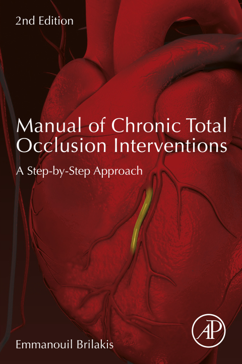 Book Manual of Chronic Total Occlusion Interventions: A Step-by-Step Approach free