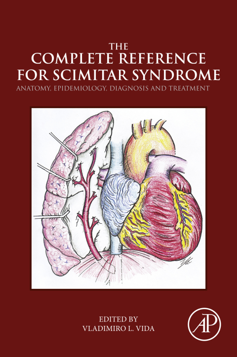 Book The Complete Reference for Scimitar Syndrome free