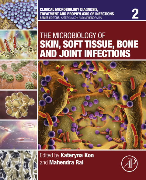 Book The Microbiology of Skin, Soft Tissue, Bone and Joint Infections free