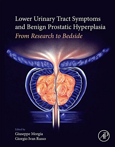 Book Lower Urinary Tract Symptoms and Benign Prostatic Hyperplasia: From Research to Bedside free
