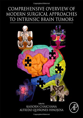 Book Comprehensive Overview of Modern Surgical Approaches to Intrinsic Brain Tumors free