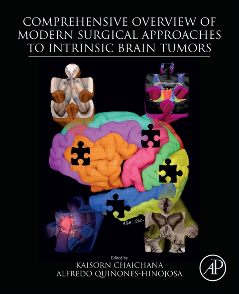 Book Comprehensive Overview of Modern Surgical Approaches to Intrinsic Brain Tumors free
