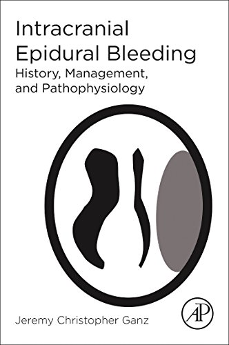 Book Intracranial Epidural Bleeding: History, Management, and Pathophysiology free