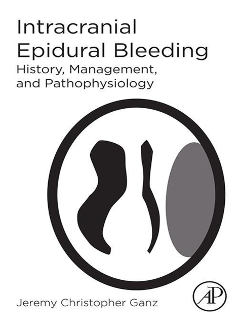 Book Intracranial Epidural Bleeding: History, Management, and Pathophysiology free