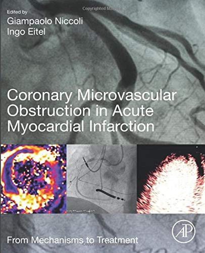 Book Coronary Microvascular Obstruction in Acute Myocardial Infarction: From Mechanisms to Treatment free
