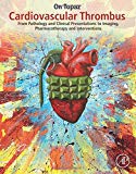 Book Cardiovascular Thrombus: From Pathology and Clinical Presentations to Imaging, Pharmacotherapy and Interventions free