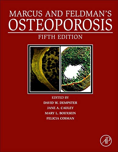 Book Marcus and Feldman's Osteoporosis free