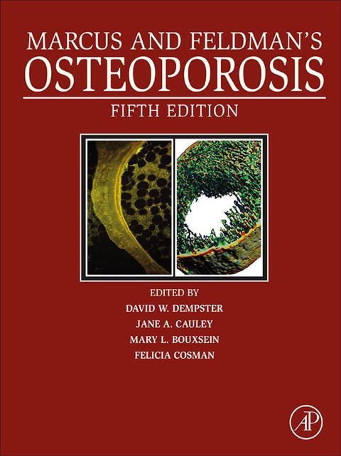 Book Marcus and Feldman's Osteoporosis free