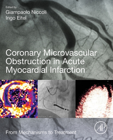 Book Coronary Microvascular Obstruction in Acute Myocardial Infarction free