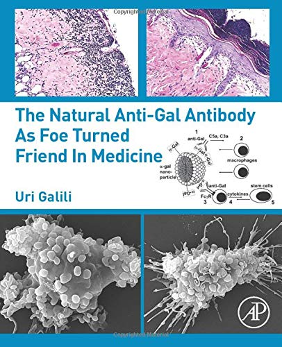 Book The Natural Anti-Gal Antibody as Foe Turned Friend in Medicine free