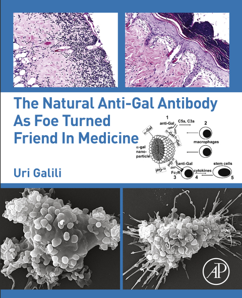 Book The Natural Anti-Gal Antibody as Foe Turned Friend in Medicine free