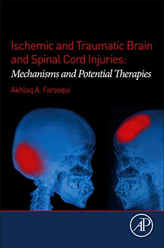 Book Ischemic and Traumatic Brain and Spinal Cord Injuries: Mechanisms and Potential Therapies free