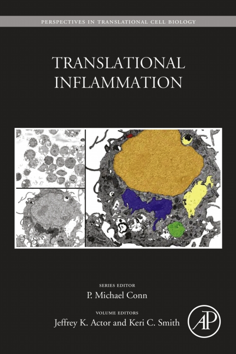 Book Translational Inflammation free