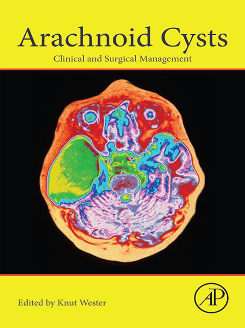 Book Arachnoid Cysts: Clinical and Surgical Management free
