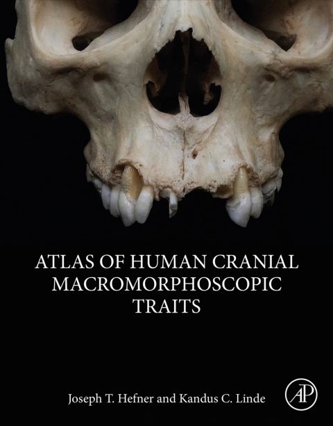 Book Atlas of Human Cranial Macromorphoscopic Traits free