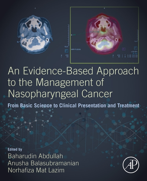 Book An Evidence-Based Approach to the Management of Nasopharyngeal Cancer: From Basic Science to Clinical Presentation and Treatment free