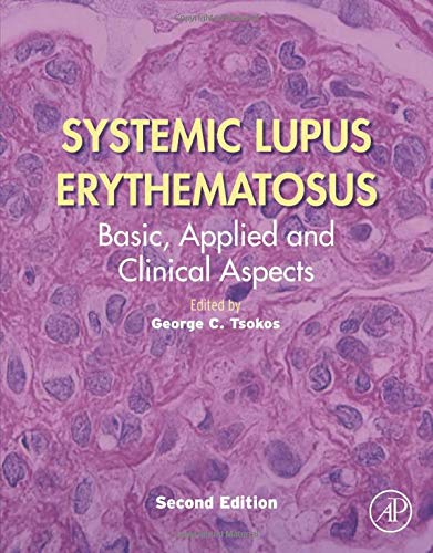 Book Systemic Lupus Erythematosus: Basic, Applied and Clinical Aspects free