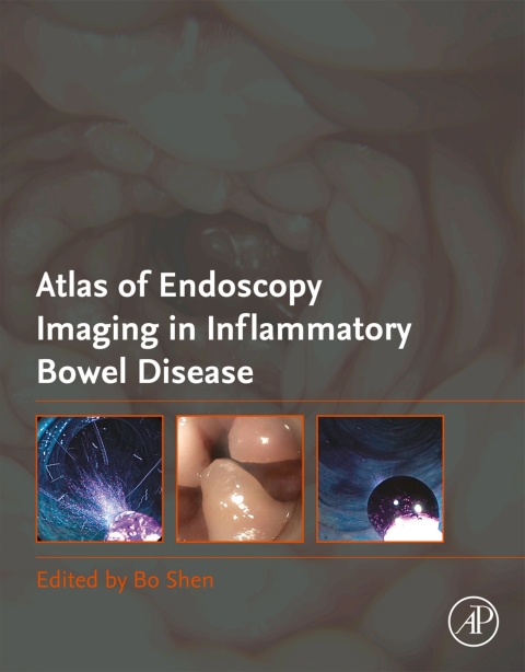 Book Atlas of Endoscopy Imaging in Inflammatory Bowel Disease free