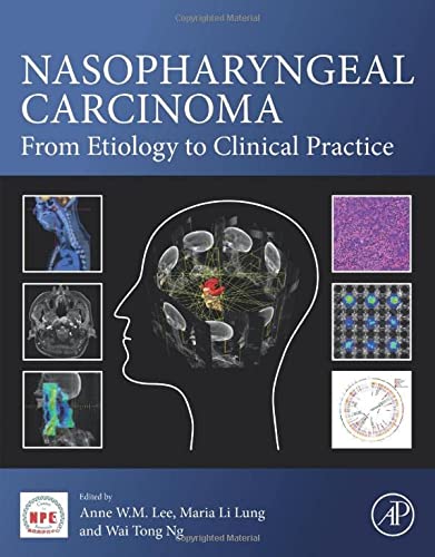 Book Nasopharyngeal Carcinoma: From Etiology to Clinical Practice free