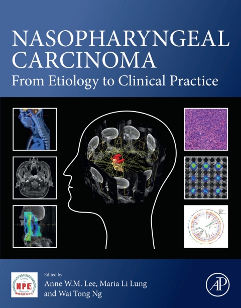 Book Nasopharyngeal Carcinoma: From Etiology to Clinical Practice free