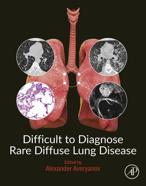 Book Difficult to Diagnose Rare Diffuse Lung Disease free
