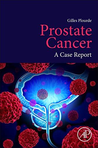 Book Prostate Cancer: A Case Report free