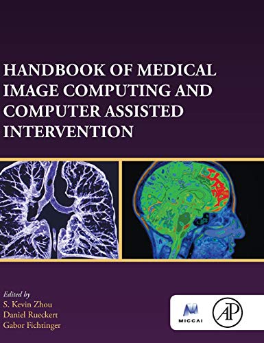 Book Handbook of Medical Image Computing and Computer Assisted Intervention (The MICCAI Society book Series) free