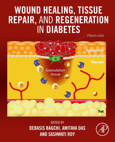Book Wound Healing, Tissue Repair, and Regeneration in Diabetes free