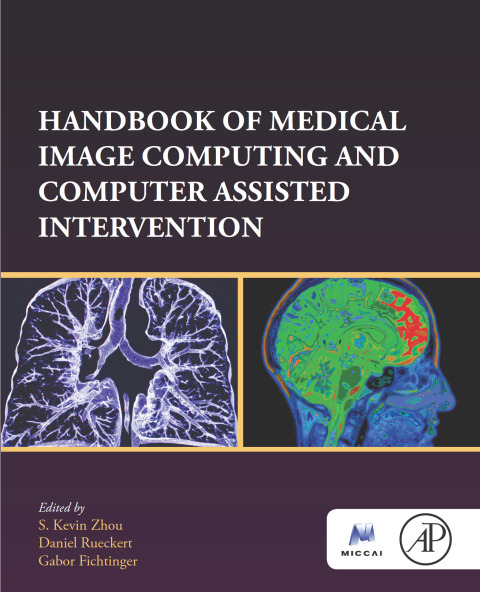 Book Handbook of Medical Image Computing and Computer Assisted Intervention (The MICCAI Society book Series) free