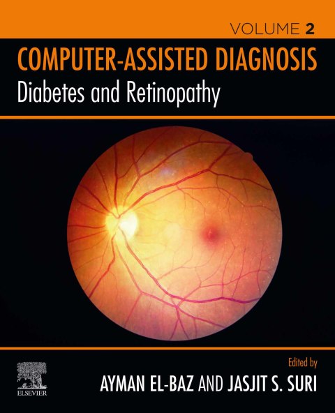 Book Diabetes and Retinopathy free