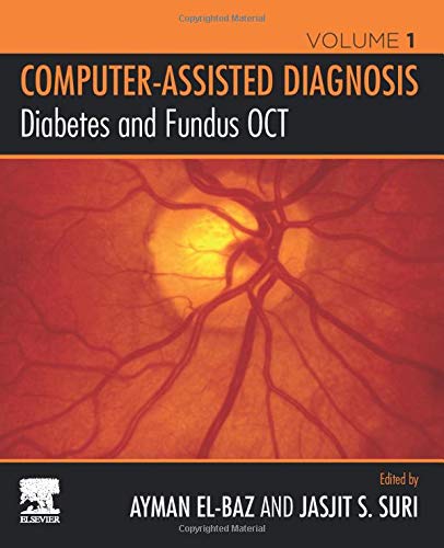 Book Diabetes and Fundus OCT (Computer-Assisted Diagnosis) free