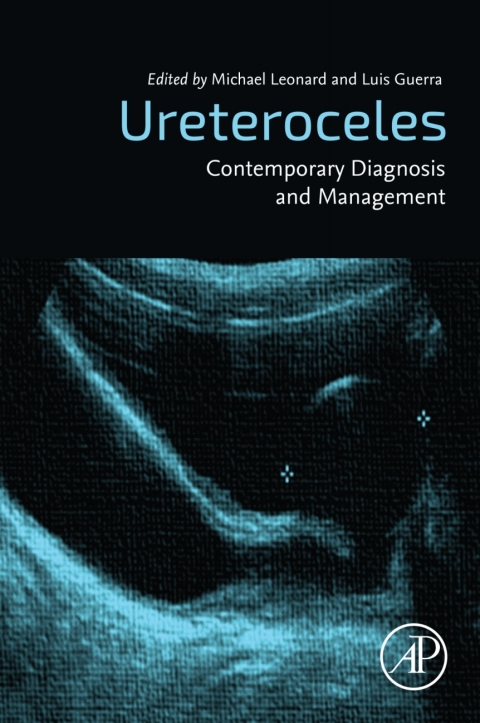 Book Ureteroceles: Contemporary Diagnosis and Management free