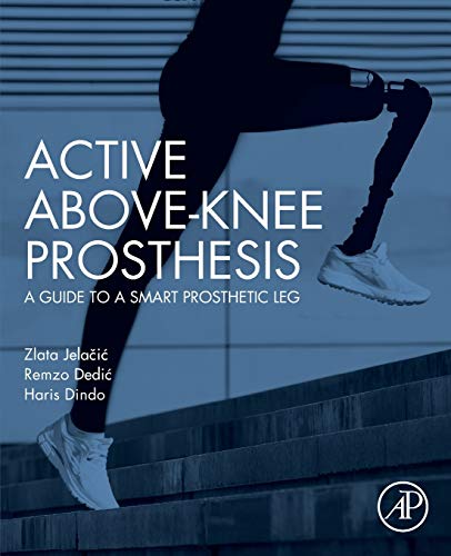 Book Active Above-Knee Prosthesis: A Guide to a Smart Prosthetic Leg free