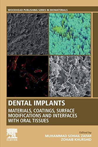 Book Dental Implants: Materials, Coatings, Surface Modifications and Interfaces with Oral Tissues (Woodhead Publishing Series in Biomaterials) free