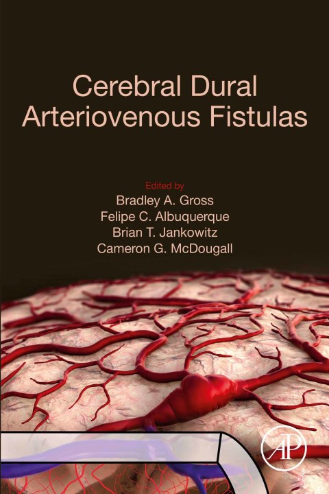 Book Cerebral Dural Arteriovenous Fistulas free