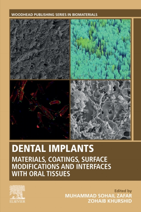 Book Dental Implants free