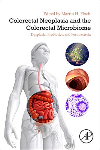 Book Colorectal Neoplasia and the Colorectal Microbiome: Dysplasia, Probiotics, and Fusobacteria free
