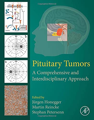 Book Pituitary Tumors: A Comprehensive and Interdisciplinary Approach free