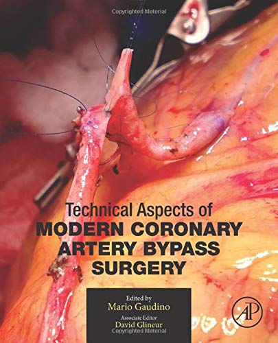 Book Technical Aspects of Modern Coronary Artery Bypass Surgery free