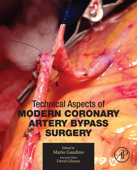 Book Technical Aspects of Modern Coronary Artery Bypass Surgery free