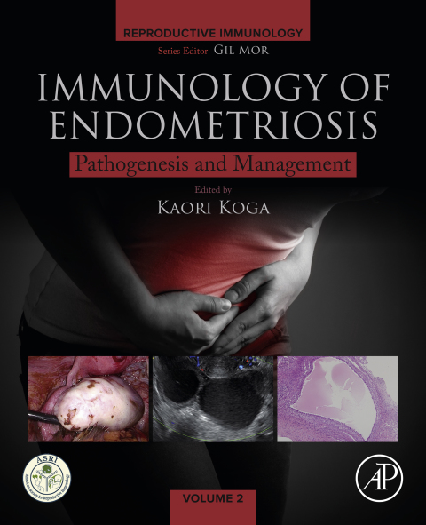 Book Immunology of Endometriosis: Pathogenesis and Management (Reproductive Immunology) free