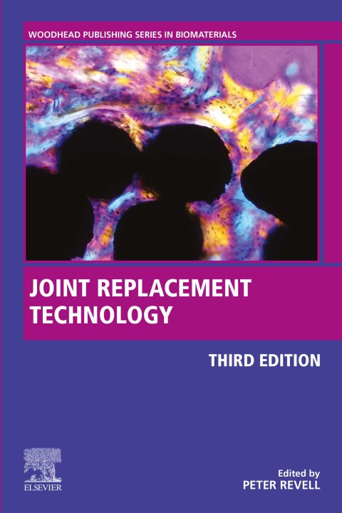Book Joint Replacement Technology free
