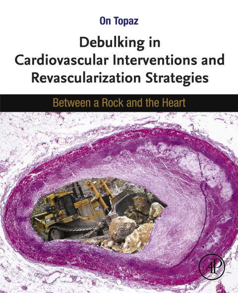 Book Debulking in Cardiovascular Interventions and Revascularization Strategies: Between a Rock and the Heart free