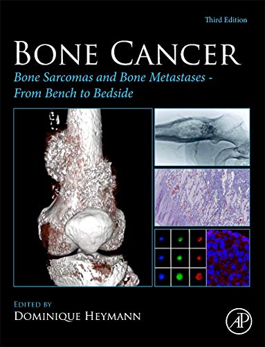 Book Bone Cancer: Bone Sarcomas and Bone Metastases - From Bench to Bedside free